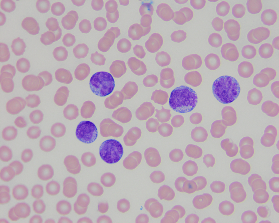 Chronic lymphocytic best sale leukemia in cats